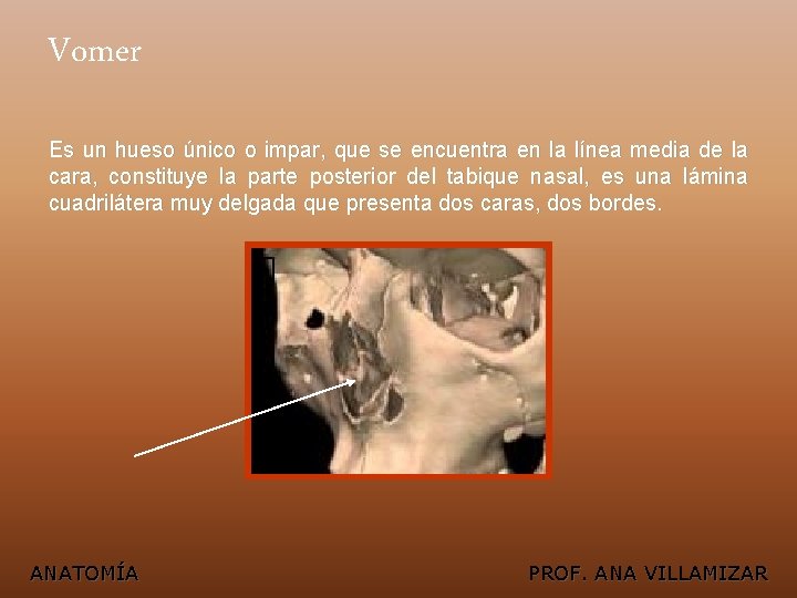 Vomer Es un hueso único o impar, que se encuentra en la línea media