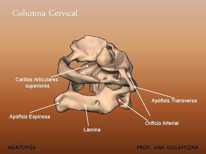 Columna Cervical Carillas Articulares superiores Apófisis Transversa Apófisis Espinosa Orificio Arterial Lámina ANATOMÍA PROF.