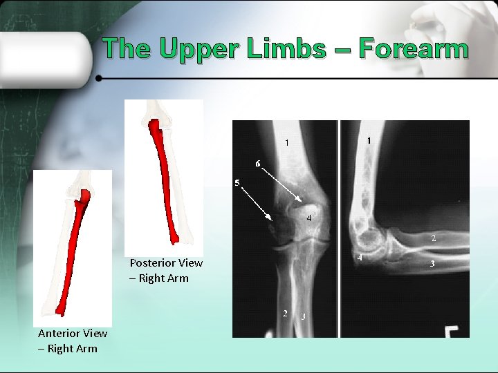 The Upper Limbs – Forearm Posterior View – Right Arm Anterior View – Right