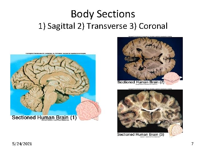 Body Sections 1) Sagittal 2) Transverse 3) Coronal 5/24/2021 7 