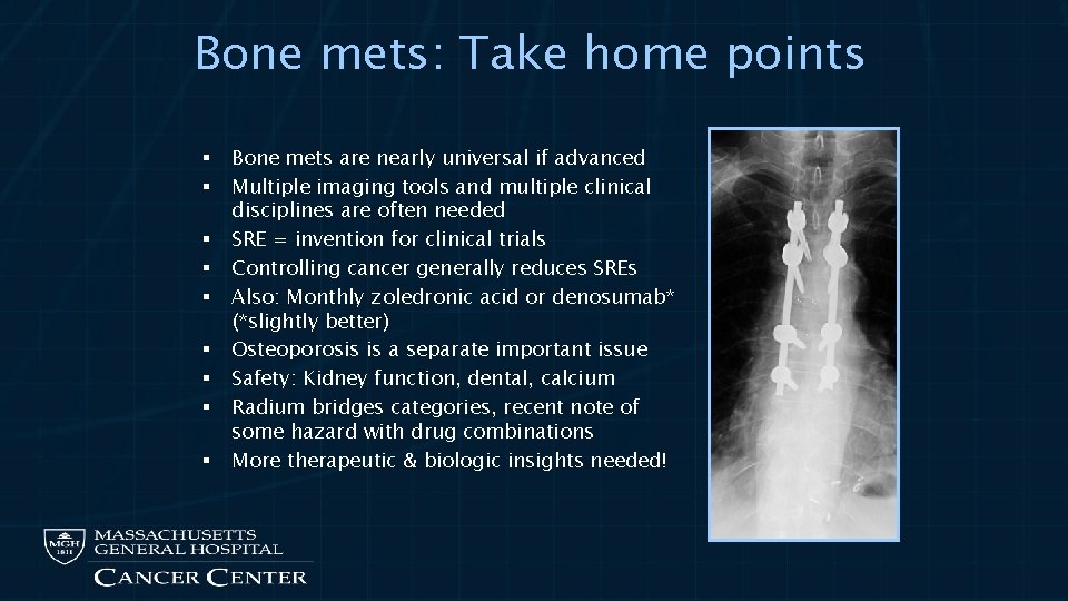 Bone mets: Take home points § § § § § Bone mets are nearly