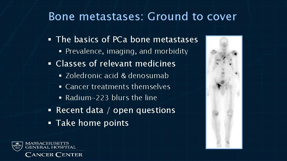 Bone metastases: Ground to cover § The basics of PCa bone metastases § Prevalence,