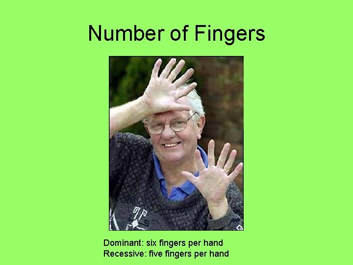 Number of Fingers Dominant: six fingers per hand Recessive: five fingers per hand 