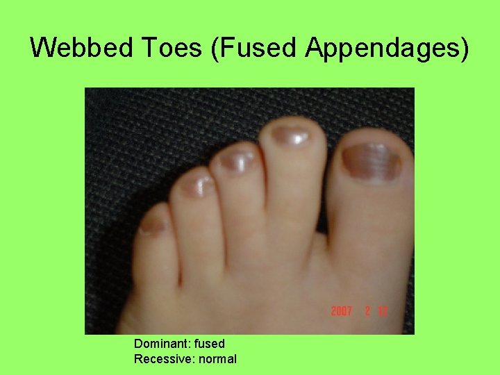 Webbed Toes (Fused Appendages) Dominant: fused Recessive: normal 