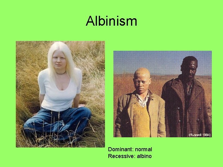 Albinism Dominant: normal Recessive: albino 