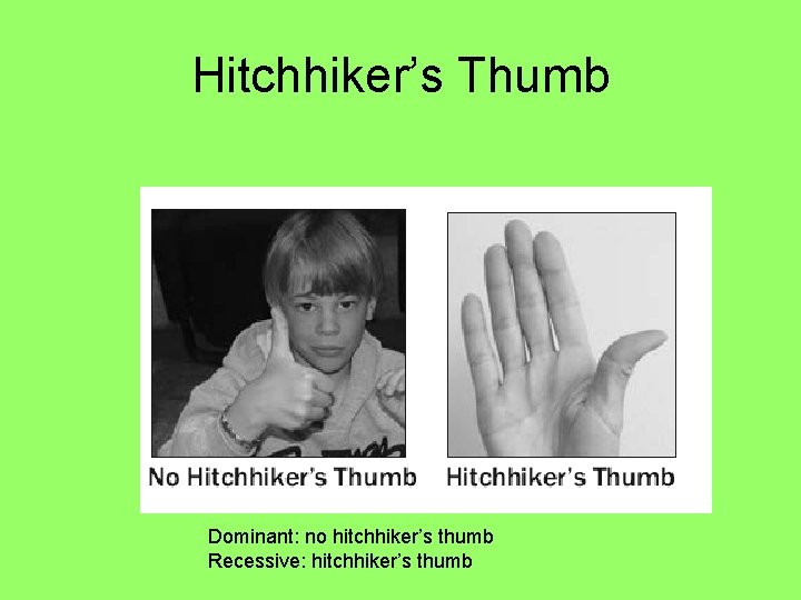 Hitchhiker’s Thumb Dominant: no hitchhiker’s thumb Recessive: hitchhiker’s thumb 
