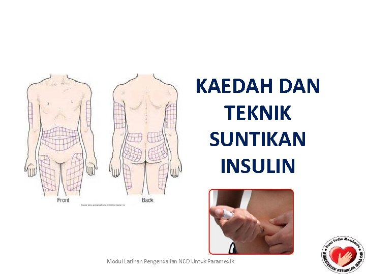 KAEDAH DAN TEKNIK SUNTIKAN INSULIN Modul Latihan Pengendalian NCD Untuk Paramedik 