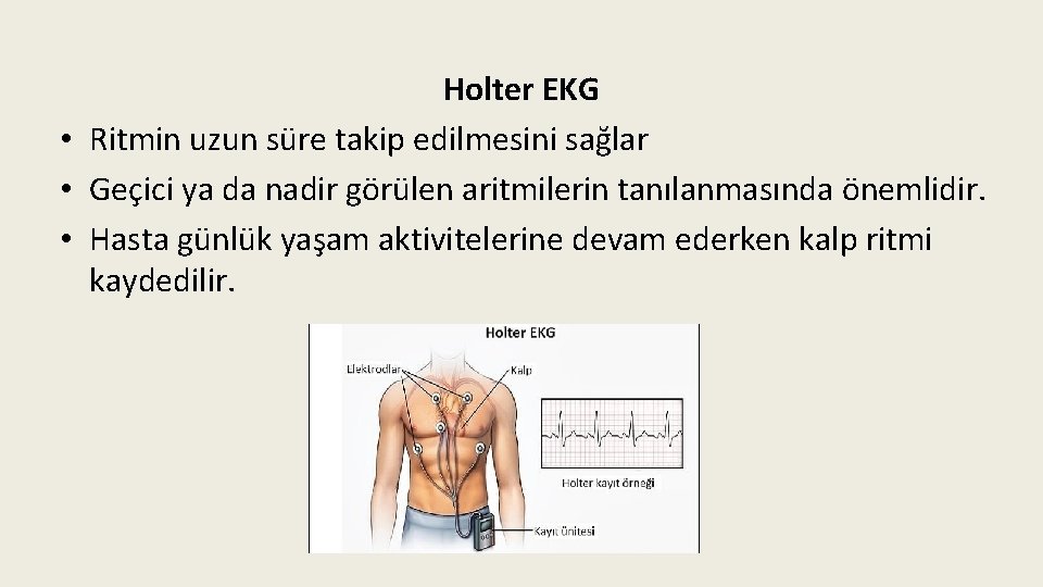 Holter EKG • Ritmin uzun süre takip edilmesini sağlar • Geçici ya da nadir