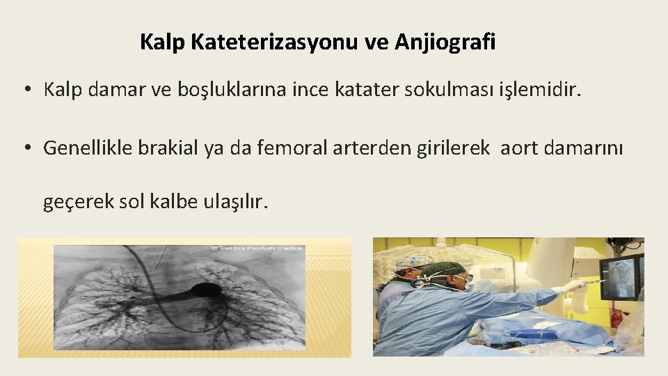 Kalp Kateterizasyonu ve Anjiografi • Kalp damar ve boşluklarına ince katater sokulması işlemidir. •