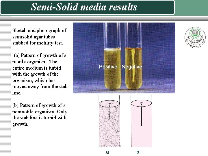 Semi-Solid media results Sketch and photograph of semisolid agar tubes stabbed for motility test.