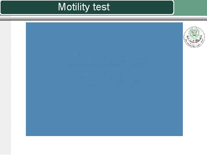 Motility test 