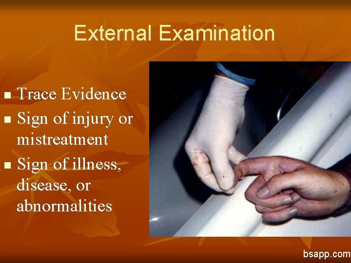 External Examination Trace Evidence n Sign of injury or mistreatment n Sign of illness,