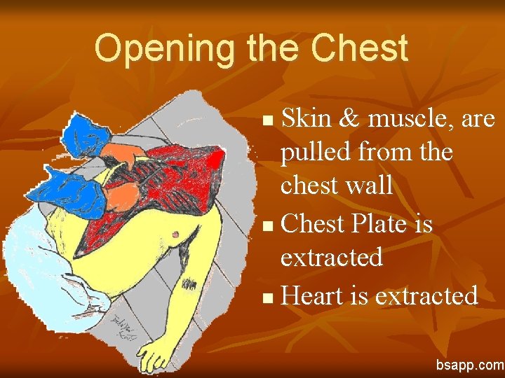 Opening the Chest Skin & muscle, are pulled from the chest wall n Chest