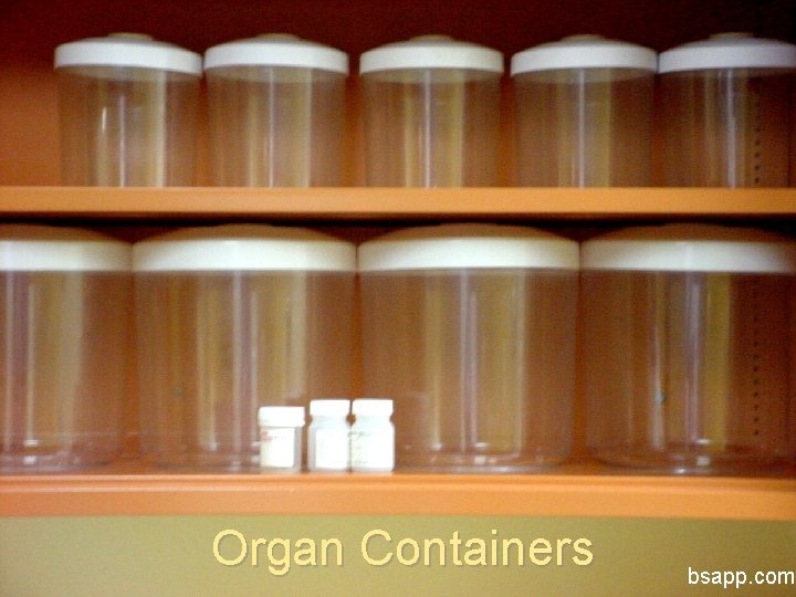 Organ Containers bsapp. com 