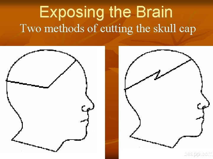 Exposing the Brain Two methods of cutting the skull cap bsapp. com 