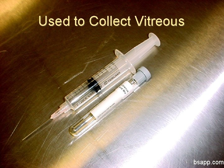 Used to Collect Vitreous bsapp. com 