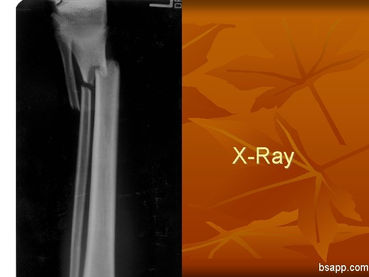 X-Ray bsapp. com 