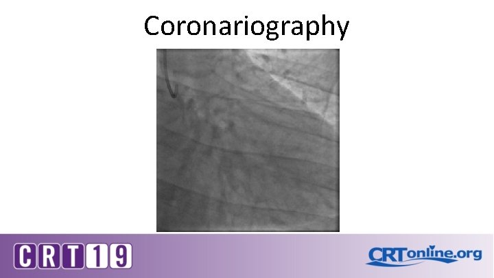 Coronariography 