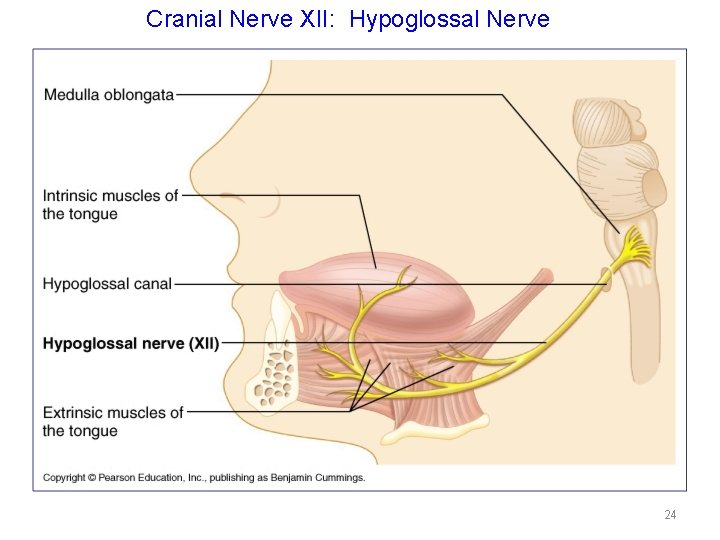 Cranial Nerve XII: Hypoglossal Nerve 24 