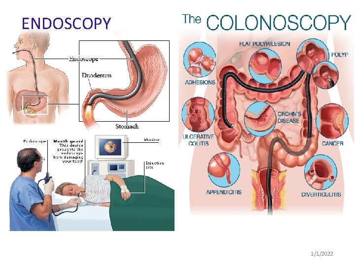 ENDOSCOPY 1/1/2022 