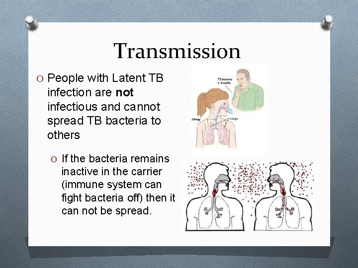 Transmission O People with Latent TB infection are not infectious and cannot spread TB