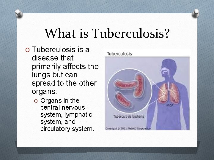 What is Tuberculosis? O Tuberculosis is a disease that primarily affects the lungs but