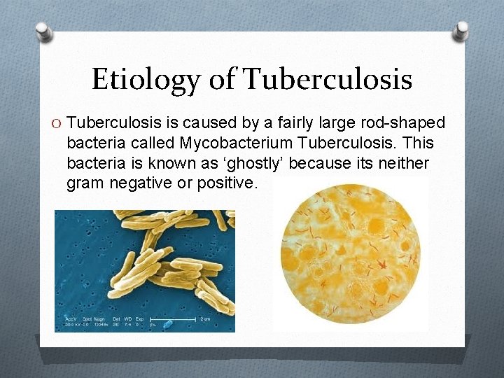 Etiology of Tuberculosis O Tuberculosis is caused by a fairly large rod-shaped bacteria called