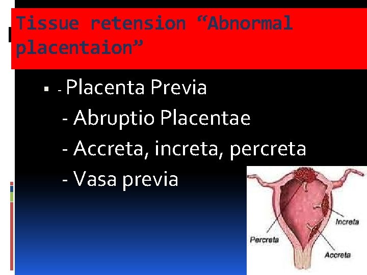 Tissue retension “Abnormal placentaion” - Placenta Previa - Abruptio Placentae - Accreta, increta, percreta Tissue retension “Abnormal placentaion” - Placenta Previa - Abruptio Placentae - Accreta, increta, percreta