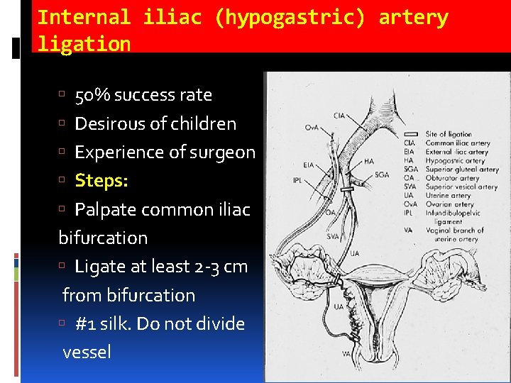 Internal iliac (hypogastric) artery ligation 50% success rate Desirous of children Experience of surgeon Internal iliac (hypogastric) artery ligation 50% success rate Desirous of children Experience of surgeon