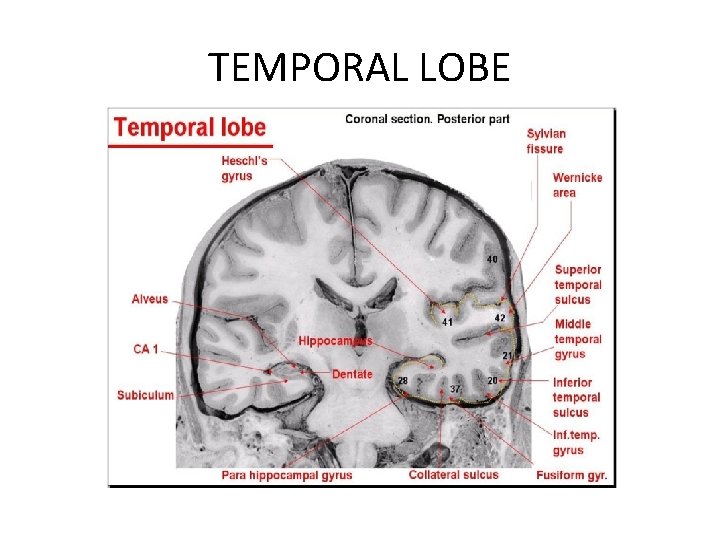 TEMPORAL LOBE 