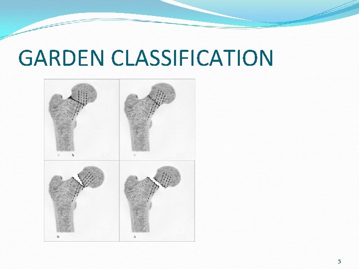 GARDEN CLASSIFICATION 5 