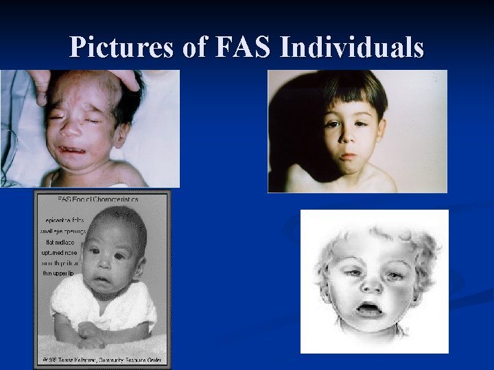 Pictures of FAS Individuals 