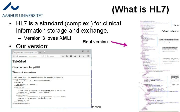 (What is HL 7) • HL 7 is a standard (complex!) for clinical information