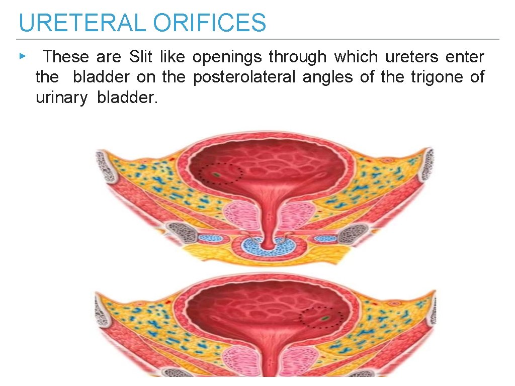 URETERAL ORIFICES ▸ These are Slit like openings through which ureters enter the bladder