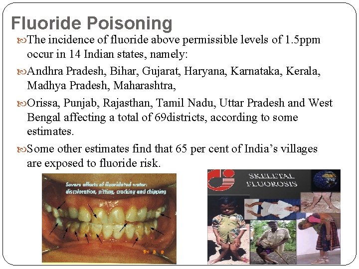 Fluoride Poisoning The incidence of fluoride above permissible levels of 1. 5 ppm occur