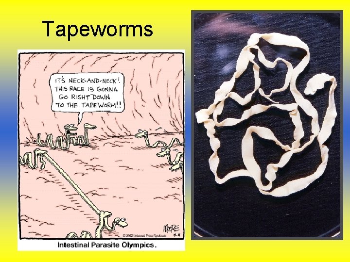 Tapeworms Tapeworms