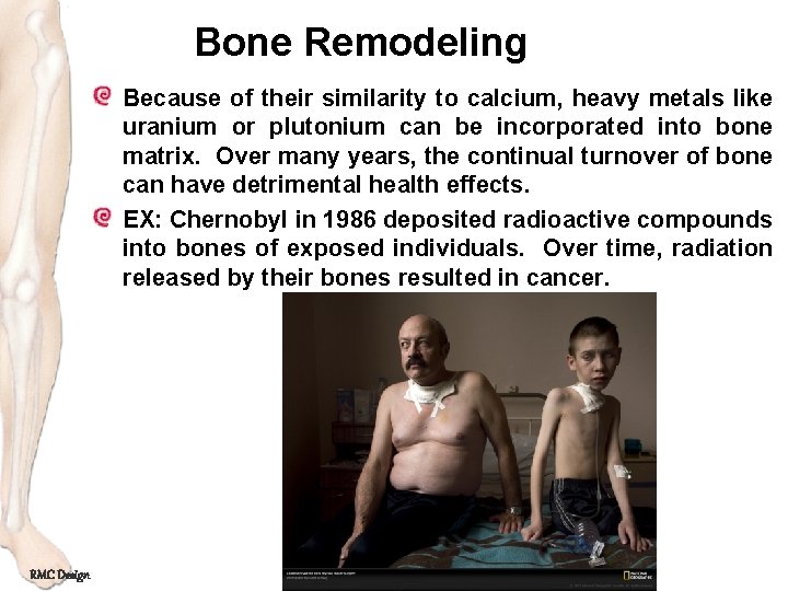 Bone Remodeling Because of their similarity to calcium, heavy metals like uranium or plutonium