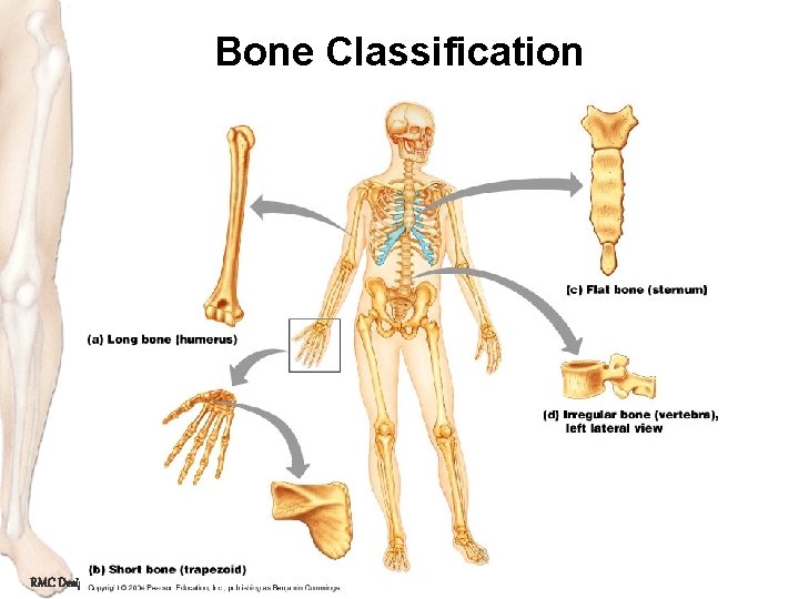 Bone Classification RMC Design 
