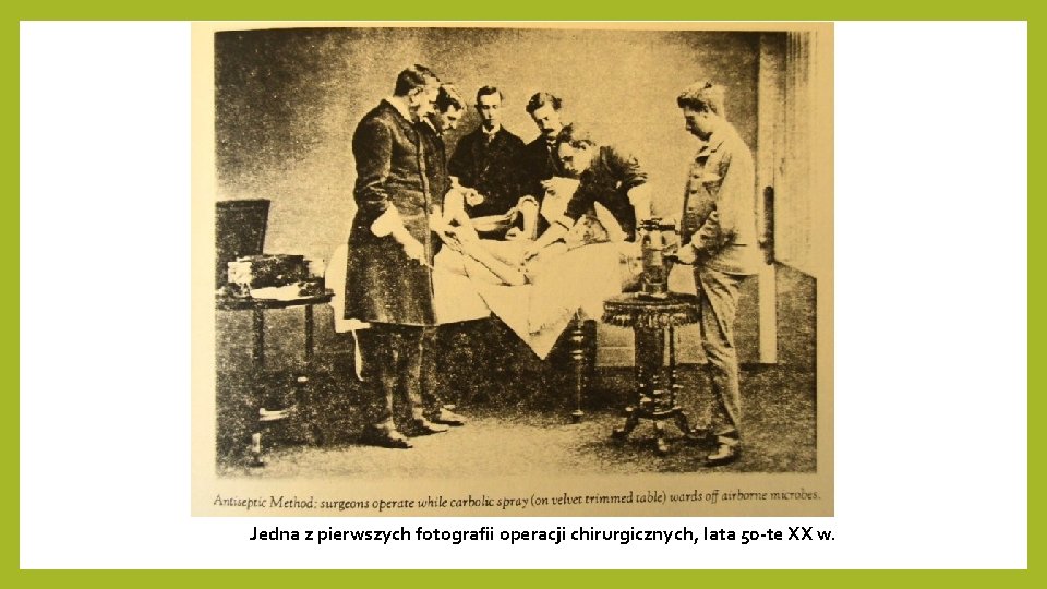 Jedna z pierwszych fotografii operacji chirurgicznych, lata 50 -te XX w. 