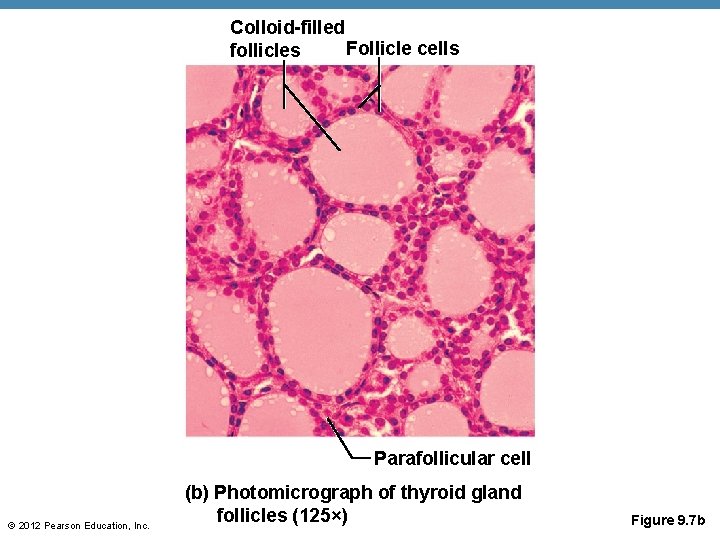 Colloid-filled Follicle cells follicles Parafollicular cell © 2012 Pearson Education, Inc. (b) Photomicrograph of