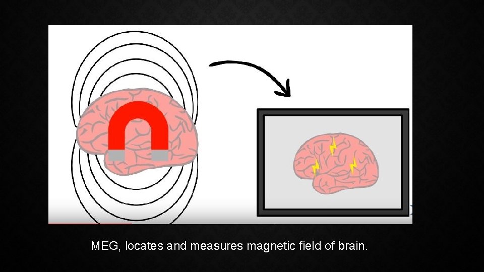 MEG, locates and measures magnetic field of brain. 