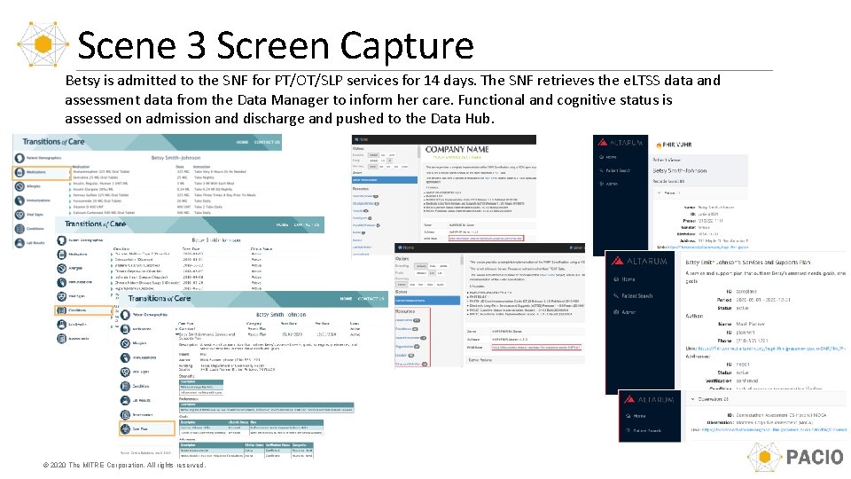 Scene 3 Screen Capture Betsy is admitted to the SNF for PT/OT/SLP services for