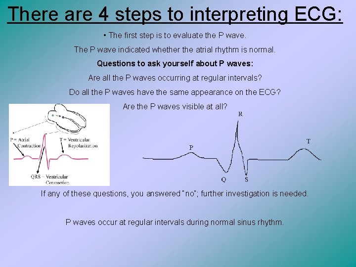 There are 4 steps to interpreting ECG: • The first step is to evaluate