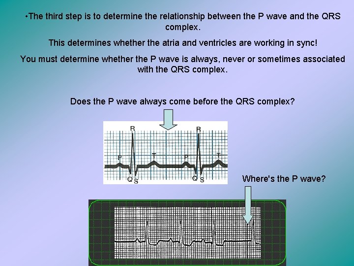  • The third step is to determine the relationship between the P wave