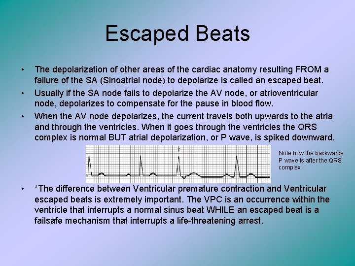 Escaped Beats • • • The depolarization of other areas of the cardiac anatomy