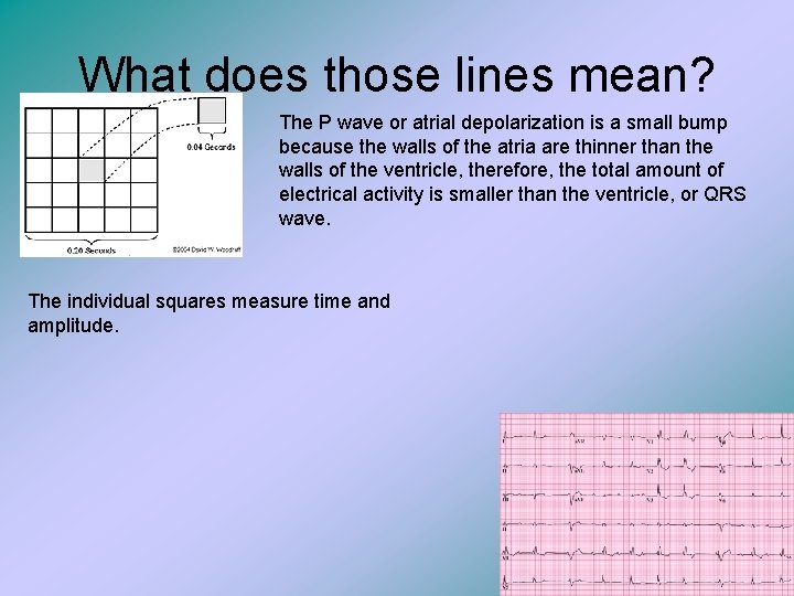 What does those lines mean? The P wave or atrial depolarization is a small