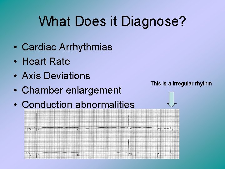 What Does it Diagnose? • • • Cardiac Arrhythmias Heart Rate Axis Deviations Chamber