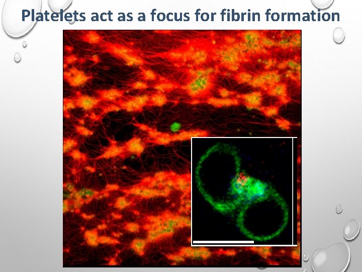 Platelets act as a focus for fibrin formation 
