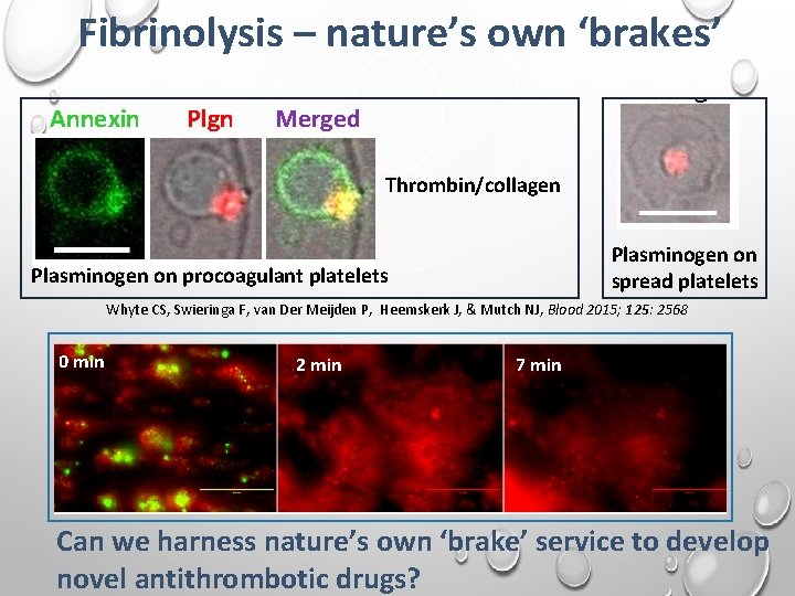 Fibrinolysis – nature’s own ‘brakes’ Annexin Plgn Merged Thrombin/collagen Plasminogen on spread platelets Plasminogen