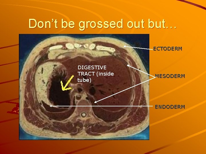 Don’t be grossed out but… ECTODERM DIGESTIVE TRACT (inside tube) MESODERM ENDODERM 